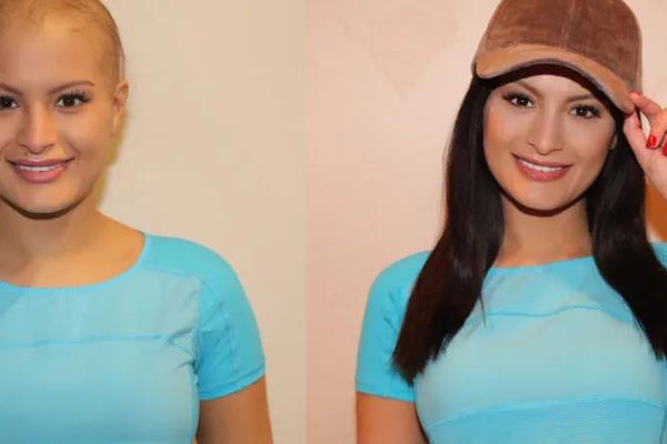You can wear a wig during chemotherapy.